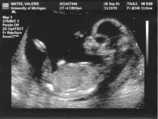 Picture 1